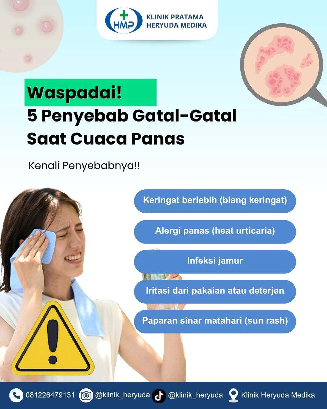 Waspadai! 5 Penyebab Gatal-Gatal Saat Cuaca Panas